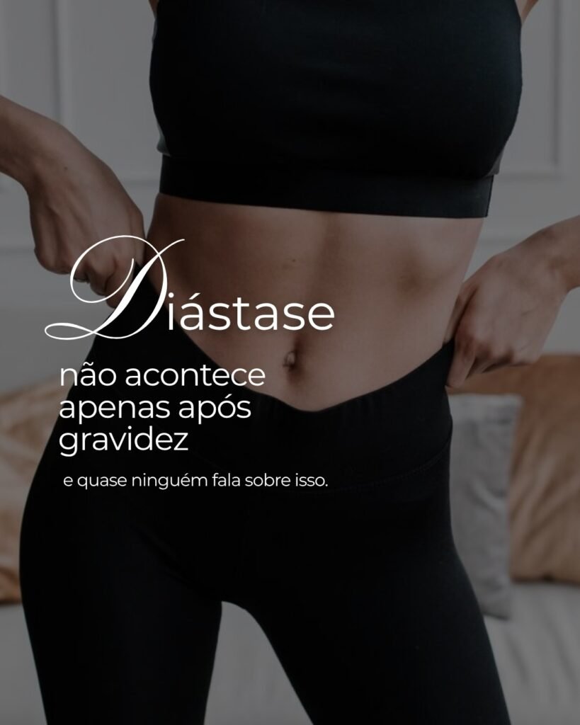 Diástase não é exclusividade da gravidez: causas e impactos na saúde abdominal