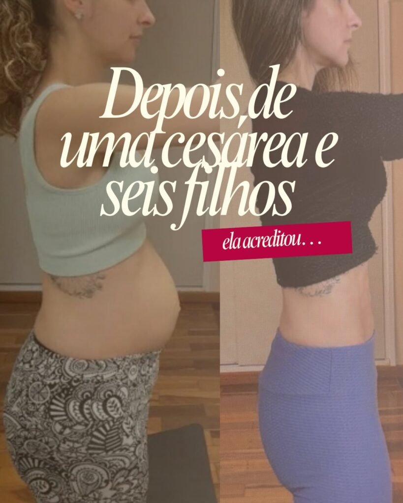 Reabilitação pós-gestação: história inspiradora mostra o poder da recuperação feminina