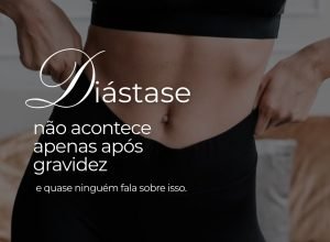 Diástase não é exclusividade da gravidez: causas e impactos na saúde abdominal