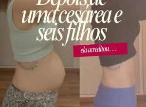 Reabilitação pós-gestação: história inspiradora mostra o poder da recuperação feminina