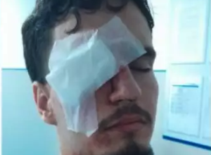 Jovem-atingido-por-bala-de-borracha-por-PM-apos-jo0016516500202605051453.png