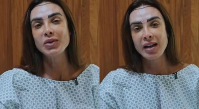 Nicole-Bahls-fez-transplante-capilar-apos-ter-alop0016570200202605231137.jpg