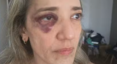 Passageira-e-agredida-por-motociclista-de-aplicati0016519300202605061236.png