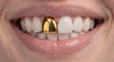 freepik__close-em-sorriso-mostrando-dente-de-ouro-polido-en__97689.jpeg
