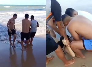 jovem-perde-a-perna.png