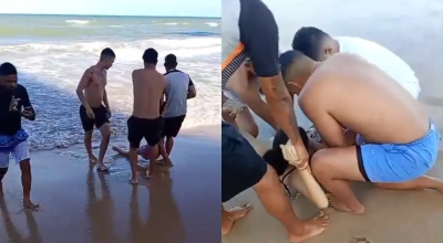 jovem-perde-a-perna.png